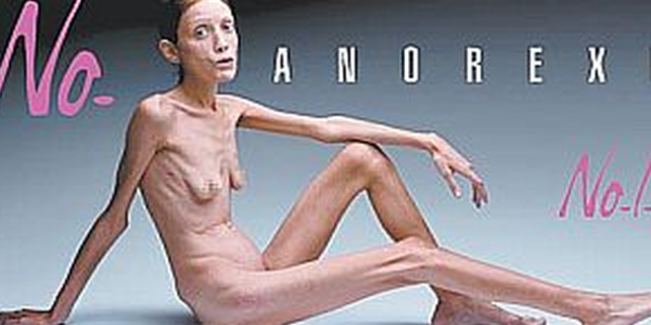 ANOREXIA
