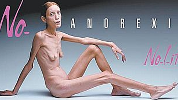 ANOREXIA
